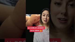 Bir doğum lekeniz varsa dikkat! #ışılışık #shorts #bilgi #paranormal screenshot 5