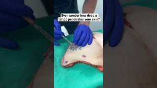 Ever wonder how deep a tattoo penetrates your skin?!😱 #mommymakeover #liposuction #tummytuck screenshot 1